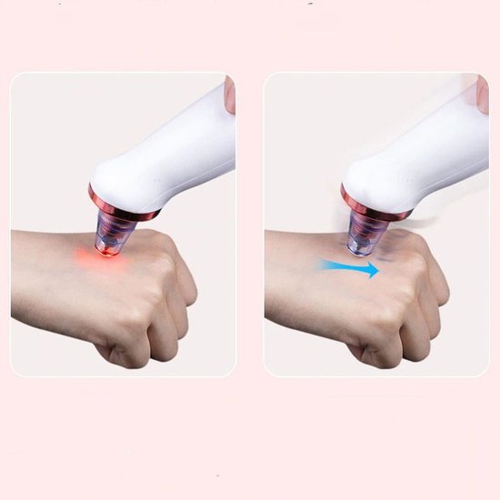 112 : Pore Cleaner & Anti-Wrinkle Device