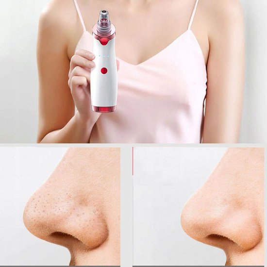 112 : Pore Cleaner & Anti-Wrinkle Device