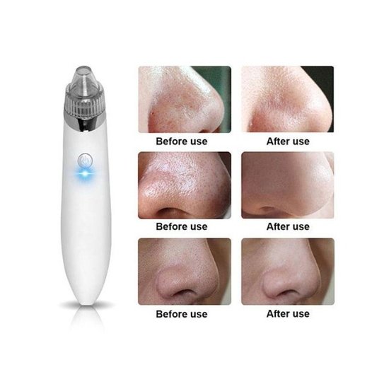 316 : Pore cleansing device