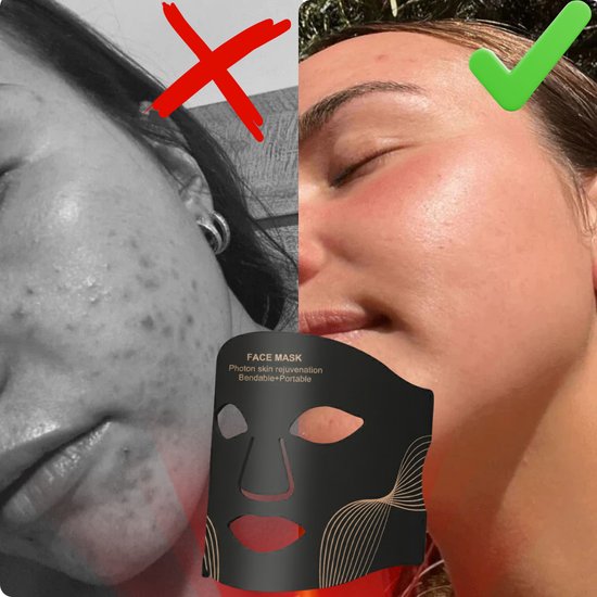 Maska na Twarz LED 7-Kolorowa – Terapia Światłem