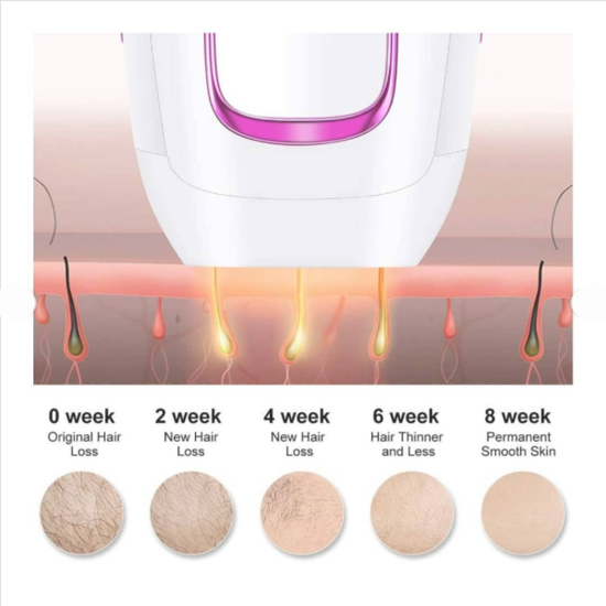 7012 : IPL Laser Hair Removal Device