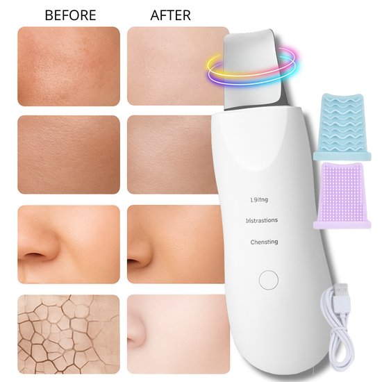 Peeling kawitacyjny do twarzy ultradźwiękowy 5w1